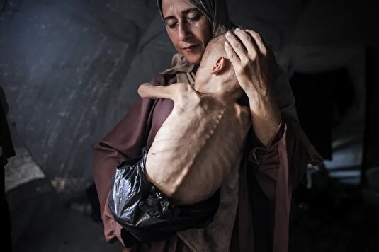 مرگ کودکان و نوزادان غزه از شدت گرسنگی