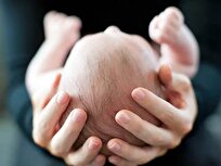 از رازهای پنهان خانواده‌ها تا جراحی‌های نجات‌بخش؛ ایران چگونه قطب درمان بیماری‌های مادرزادی شد؟