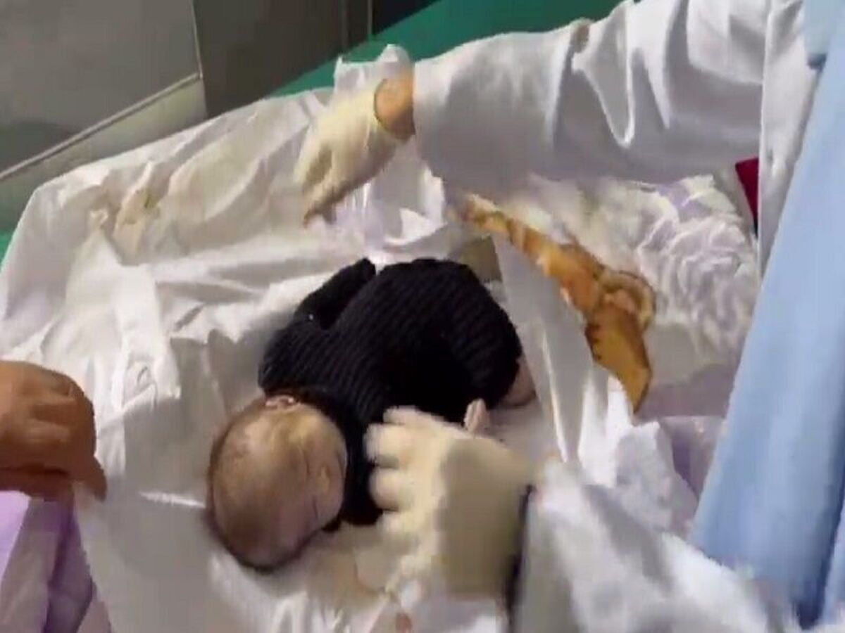 شهادت غیرنظامیان در صف کمکها و جانباختن نوزادان بر اثر گرسنگی