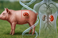 یک گام به جلو در نبرد با کمبود اعضای پیوندی
