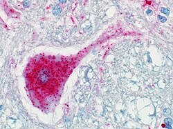 اسکراپی در گوسفندان