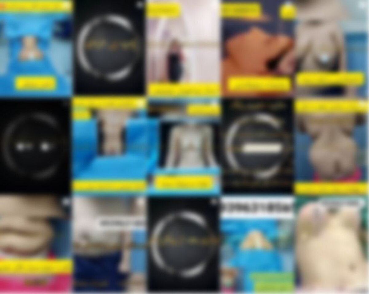 بدن بیماران در ویترین تبلیغات زیبایی؛ بحران اخلاقی در سایه‌ی بی‌نظارتی