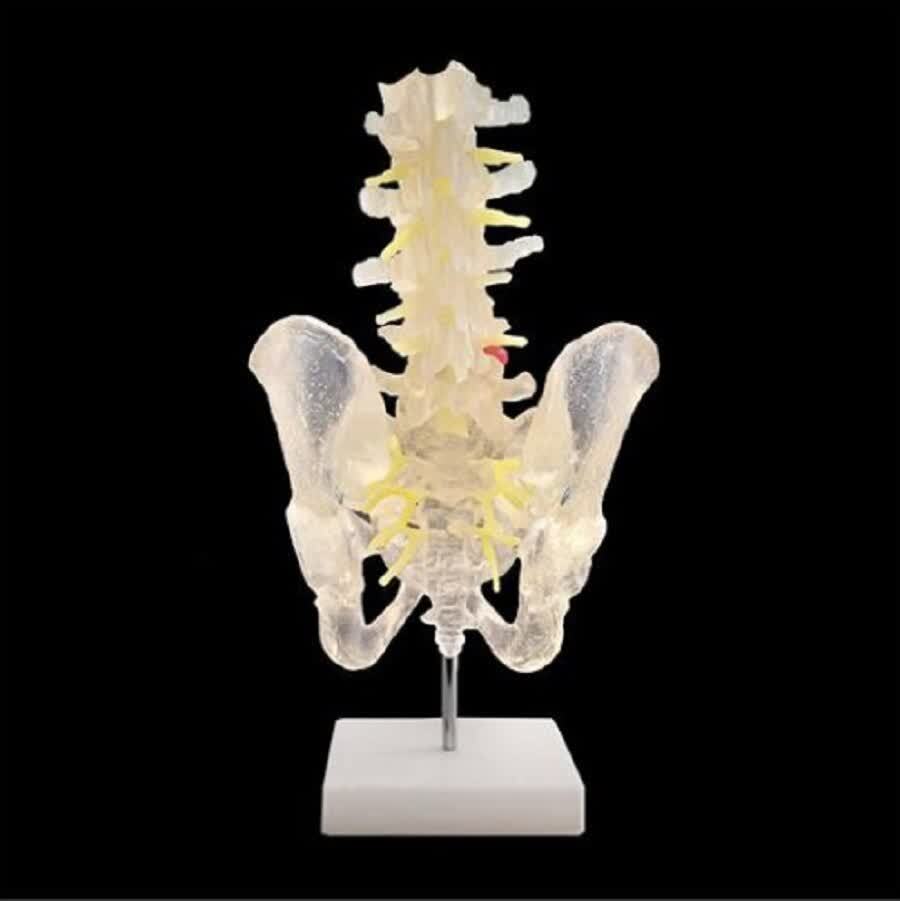 فناوری چاپ سه بعدی در پزشکی؛ از ارتز و پروتزهای سفارشی تا انواع مولاژها +فیلم و عکس فناوری چاپ سه بعدی در پزشکی؛ از ارتز و پروتزهای سفارشی تا انواع مولاژها +فیلم و عکس