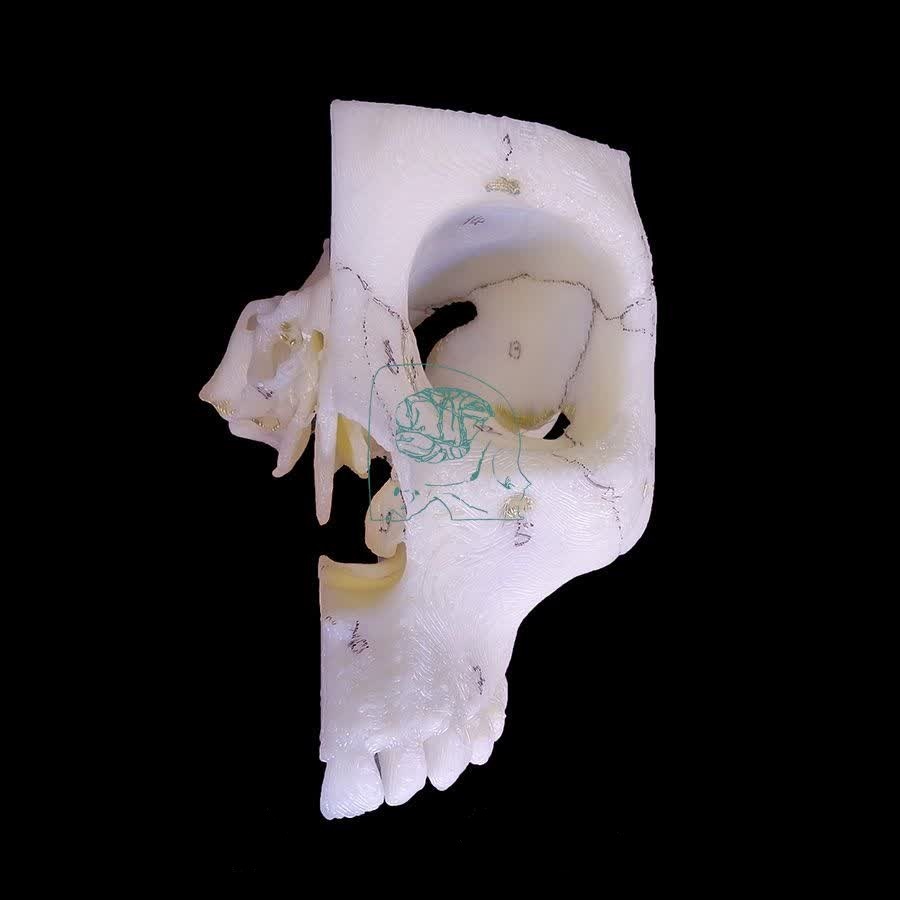 فناوری چاپ سه بعدی در پزشکی؛ از ارتز و پروتزهای سفارشی تا انواع مولاژها +فیلم و عکس فناوری چاپ سه بعدی در پزشکی؛ از ارتز و پروتزهای سفارشی تا انواع مولاژها +فیلم و عکس