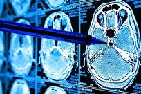 کاهش خطاهای رادیولوژی با هوش مصنوعی