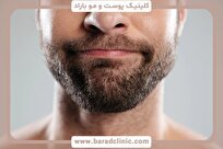 راهنمای انتخاب بهترین کلینیک کاشت ریش؛ تجربه‌ای مطمئن برای ریشی پرپشت و مردانه