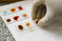 نادرترین گروه خونی جهان و تلاش برای خلق «خون طلایی»