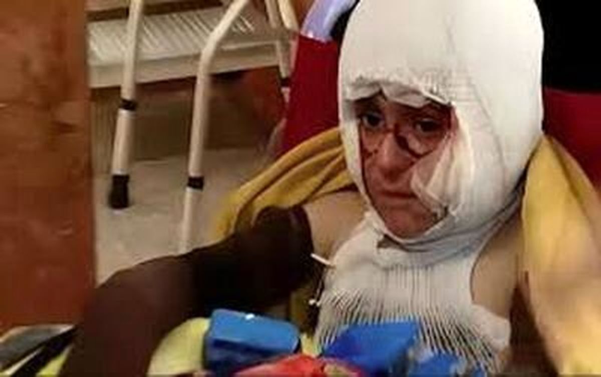 سخنان متاثر کننده رئیس بنیادشهید در توصیف شدت جراحات «کیان قاسمیان» + فیلم سخنان متاثر کننده رئیس بنیادشهید در توصیف شدت جراحات «کیان قاسمیان» + فیلم