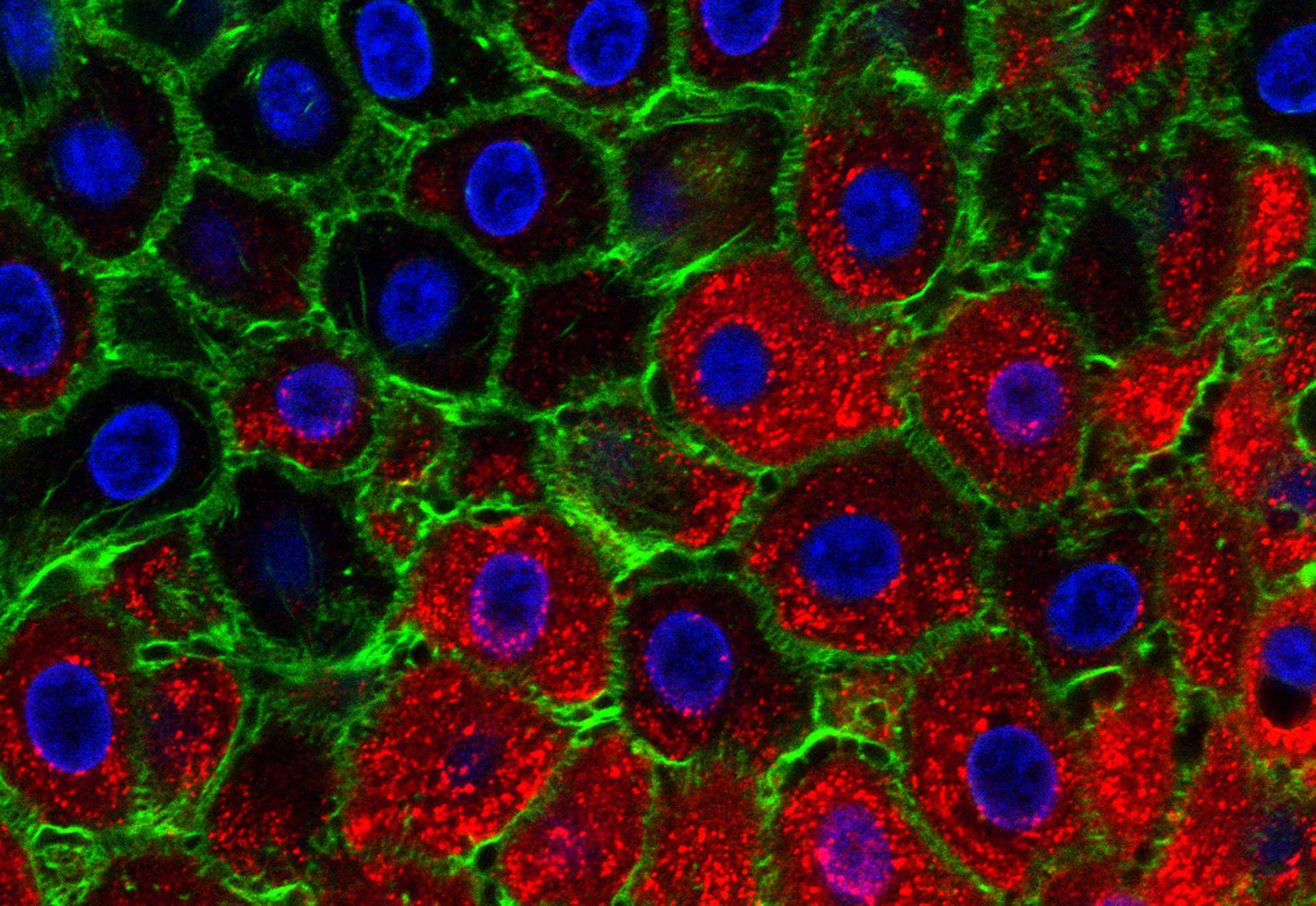 ویروس تب برفکی ویروس تب برفکی