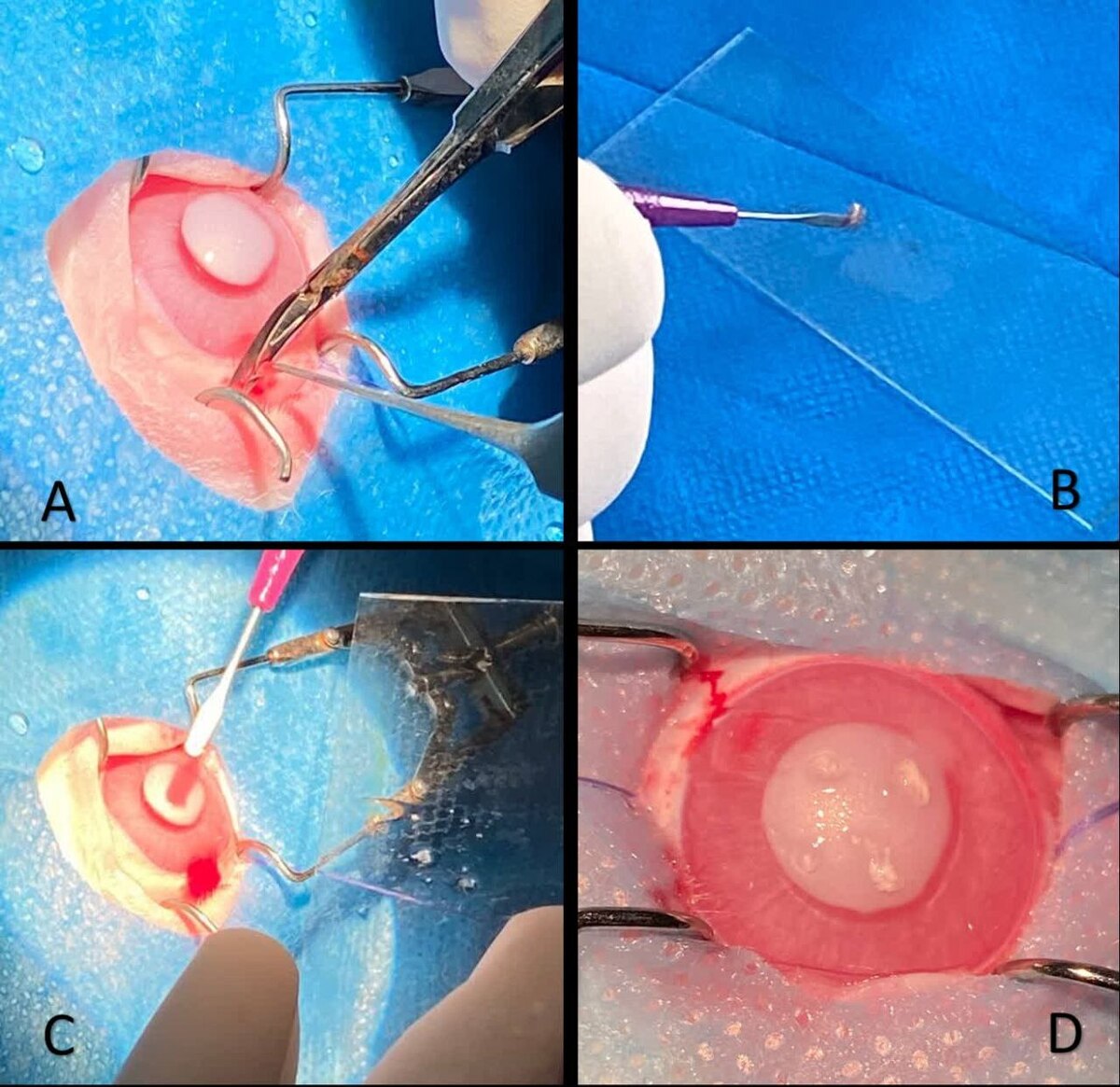 ترمیم زخم قرنیه با روش جدید در دانشگاه تهران