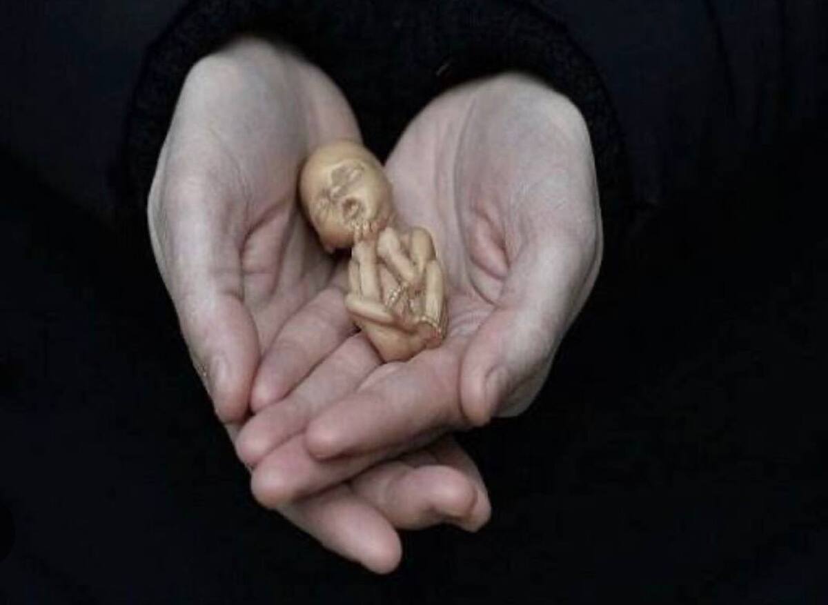 سقط غیرقانونی، تهدیدی جدی و پنهان برای سلامت مادران