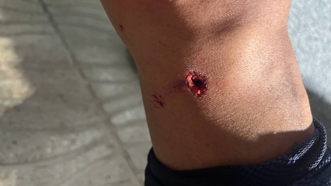 جرجانی: فجریها به دنبال فرافکنی هستند/ پایم در گچ است و بازیکن فجر اخطار هم نگرفت جرجانی: فجریها به دنبال فرافکنی هستند/ پایم در گچ است و بازیکن فجر اخطار هم نگرفت