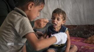 گرسنگی فاجعه بار در غزه