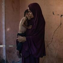 گرسنگی فاجعه بار در غزه