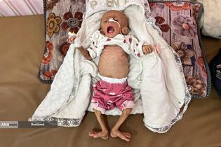 بحران گرسنگی فزاینده غزه