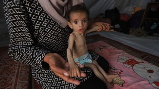 محاصره بی‌رحمانه غزه حکایت از مرگ کودکان و سالمندان بر اثر گرسنگی و سوءتغذیه دارد