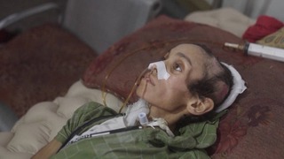 محاصره بی‌رحمانه غزه حکایت از مرگ کودکان و سالمندان بر اثر گرسنگی و سوءتغذیه دارد