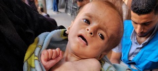 محاصره بی‌رحمانه غزه حکایت از مرگ کودکان و سالمندان بر اثر گرسنگی و سوءتغذیه دارد