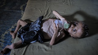 محاصره بی‌رحمانه غزه حکایت از مرگ کودکان و سالمندان بر اثر گرسنگی و سوءتغذیه دارد