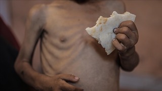 محاصره بی‌رحمانه غزه حکایت از مرگ کودکان و سالمندان بر اثر گرسنگی و سوءتغذیه دارد