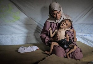 محاصره بی‌رحمانه غزه حکایت از مرگ کودکان و سالمندان بر اثر گرسنگی و سوءتغذیه دارد