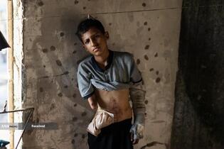 جنایت های بی پایان در غزه