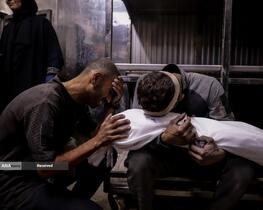 کودکانی که در غزه بر اثر گرسنگی تبدیل به اسکلت شده‌اند