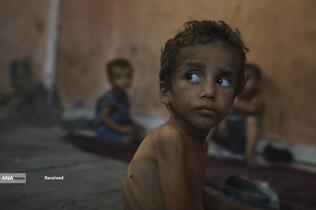 کودکانی که در غزه بر اثر گرسنگی تبدیل به اسکلت شده‌اند