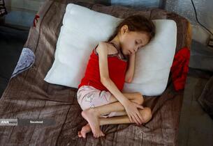 کودکانی که در غزه بر اثر گرسنگی تبدیل به اسکلت شده‌اند