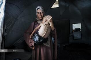 کودکانی که در غزه بر اثر گرسنگی تبدیل به اسکلت شده‌اند