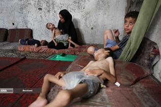 کودکانی که در غزه بر اثر گرسنگی تبدیل به اسکلت شده‌اند