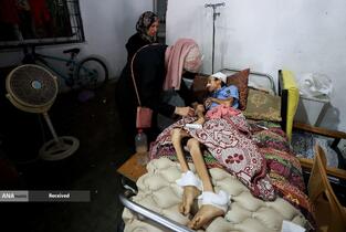 کودکانی که در غزه بر اثر گرسنگی تبدیل به اسکلت شده‌اند