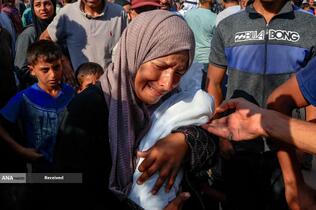 کودکانی که در غزه بر اثر گرسنگی تبدیل به اسکلت شده‌اند