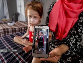 کودکانی که در غزه بر اثر گرسنگی تبدیل به اسکلت شده‌اند