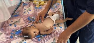 کودکانی که در غزه بر اثر گرسنگی تبدیل به اسکلت شده‌اند