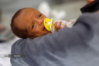 کودکانی که در غزه بر اثر گرسنگی تبدیل به اسکلت شده‌اند