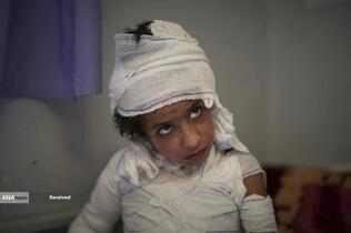 کشتار بی رحمانه در غزه