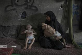 کودکان غزه در صف مرگ بدلیل سوء&zwnj;تغذیه، گرسنگی، و کمبود کمک&zwnj;ها و خدمات حیاتی