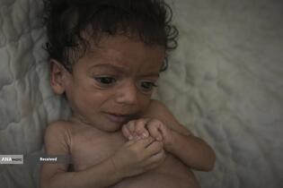 کودکان غزه در صف مرگ بدلیل سوء&zwnj;تغذیه، گرسنگی، و کمبود کمک&zwnj;ها و خدمات حیاتی