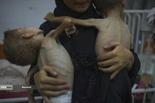 کودکان غزه در صف مرگ بدلیل سوء&zwnj;تغذیه، گرسنگی، و کمبود کمک&zwnj;ها و خدمات حیاتی