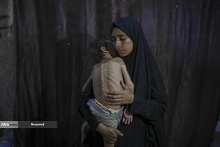 کودکان غزه در صف مرگ بدلیل سوء&zwnj;تغذیه، گرسنگی، و کمبود کمک&zwnj;ها و خدمات حیاتی