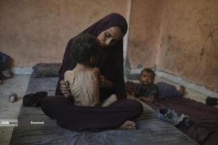 کودکان غزه در صف مرگ بدلیل سوء&zwnj;تغذیه، گرسنگی، و کمبود کمک&zwnj;ها و خدمات حیاتی