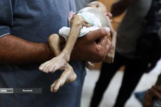 کودکان غزه در صف مرگ بدلیل سوء&zwnj;تغذیه، گرسنگی، و کمبود کمک&zwnj;ها و خدمات حیاتی