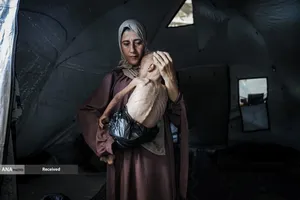 کودکانی که در غزه بر اثر گرسنگی تبدیل به اسکلت شده&zwnj;اند