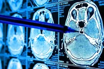 کاهش خطاهای رادیولوژی با هوش مصنوعی