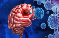 New post-surgery windows could improve brain tumor treatment