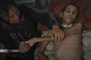 کودکان غزه در صف مرگ بدلیل سوء&zwnj;تغذیه، گرسنگی، و کمبود کمک&zwnj;ها و خدمات حیاتی