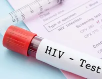 از تغییر الگوی انتقال تا دسترسی وسیع به درمان؛ تصویر امروز HIV در ایران