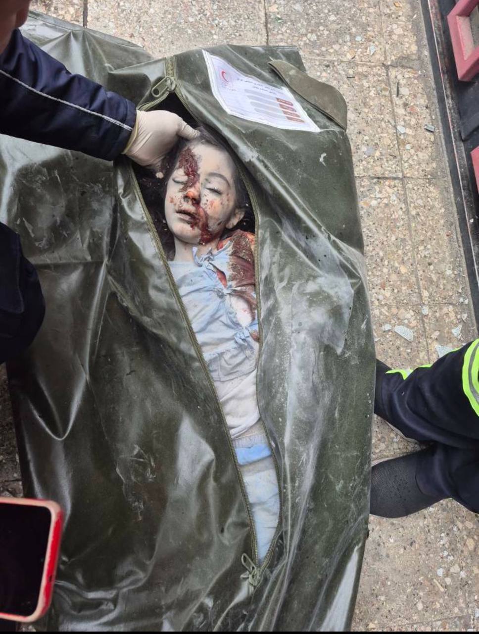 شهادت دختر ۷ ساله در حمله امروز رژیم صهیونیستی به تهران/ مجروحیت سه کودک دیگر