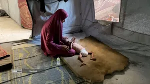 کودکانی که در غزه بر اثر گرسنگی تبدیل به اسکلت شده&zwnj;اند